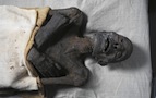 mummies disease